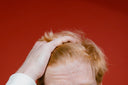 A man with thinning hair, holding his hair back.