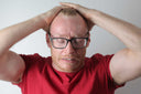 A man holds his hair back revealing a receded hair line.