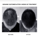 CD Plus | Ultra Thickening Anti Hair Loss Conditioner