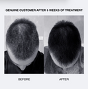 SH Plus | Ultra Thickening Anti Hair Loss Shampoo
